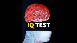 IQ Test Check your IQ 🏆