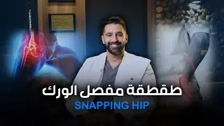 طقطقة مفصل الورك | Snapping hip