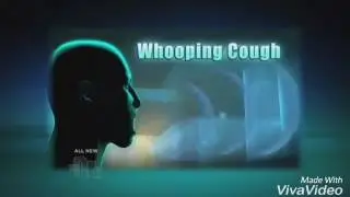 Different types of cough sounds