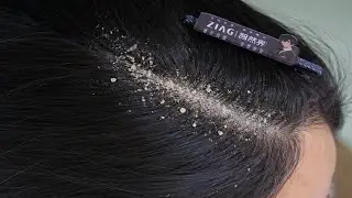 Calming Hair Scalp ASMR | Slow and Relaxing Cleaning Therapy