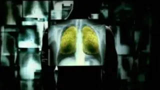 India Sponge Campaign by World Lung Foundation