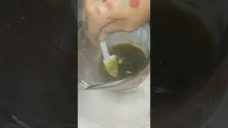 Homemade Brown Recluse Spider Bite Remedy (works wounds, sores, staph & mrsa as well)