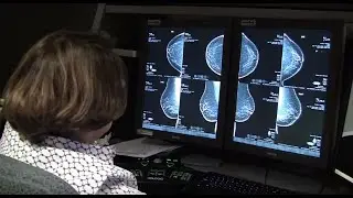 3D Mammography - Nebraska Medicine