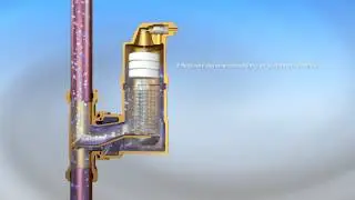 SpiroVent RV2