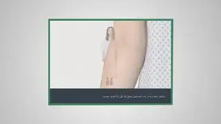 طريقة تشخيص السرطان بجهاز PET Scan | Diagnosing Cancer using PET Scan