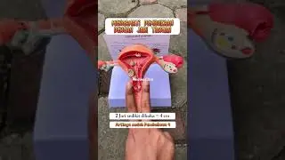 simulasi pembukaan Melahirkan - Medikacare