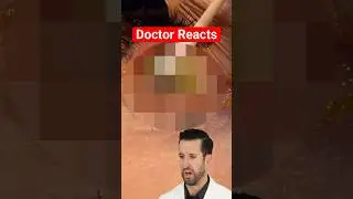Врач смотрит на 