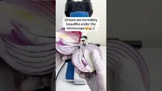 Onion Under A Microscope #underamicroscope