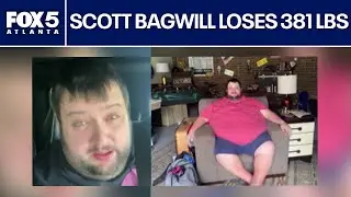 Scott Bagwill's weight loss journey | FOX 5 News