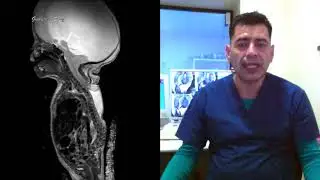 Digitalizaci&oacute;n de la imagen m&eacute;dica. DICOM, RIS, HIS, PACS