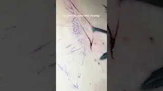 Tattoo Skin Depth Tips