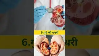 यूरोलॉजिस्ट से मिलने के 9 लक्षण #urologist #urinaryincontinence #urineproblems