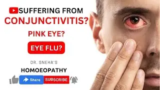 EYE FLU: Everything you need to know about Conjunctivitis/Pink Eye : Causes, Types and Management