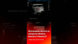 Визуализация щитовидной железы на Mindray Resona 6 и Resona i9 #mindray #shorts #short