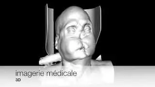 PROTHESE FACIALE 3D