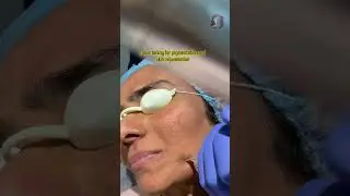 Skin Rejuvenation with Laser Toning