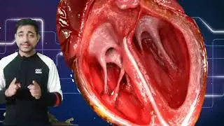 Heart-As the most important organ of Circulatory System