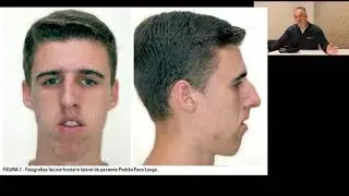 Respiração Bucal