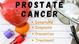 Prostate Cancer: Must-Know Facts Every Man Should Hear