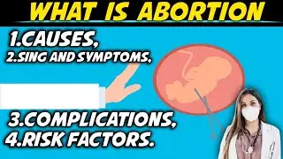 Abortion || Easy explanation in hindi || Abortion sign, symptoms, causes, comlications, Risk factors