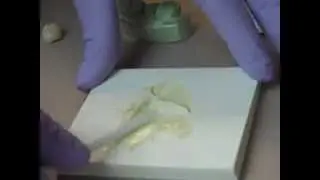How to put a temporary crown back on.