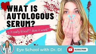 Do Autologous Serum Eye Drops Work? What Is Autologous Serum? | An Eye Doctor Explains