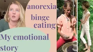 My Eating Disorder Story (w pics) | anorexia, binge eating, exercise obsession, fasting, vegan diet