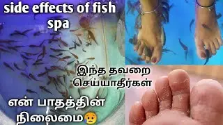 Side effects of Fish Spa/ என் பாதத்தின் நிலைமை என்ன ஆச்சுன்னு தெரியுமா!
