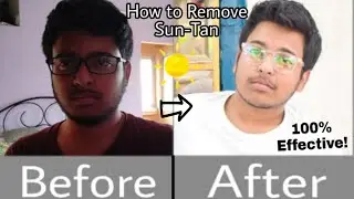 How To Remove Suntan Quickly | Easy Suntan Protection Removal Treatment | TDF MI&m | Ep.01