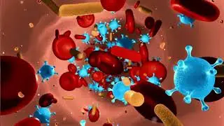 How Monkeypox Virus Spread? Monkeypox causes, Symptoms & prevention By Dr Zain ul Abadin