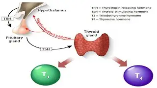 WHAT CAUSES HYPOTHYROIDISM?
