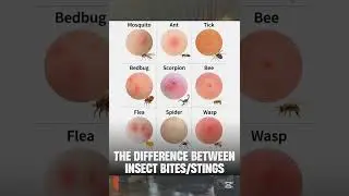 Inset bites vs Stings #insectbite #sting #ytshorts #shots