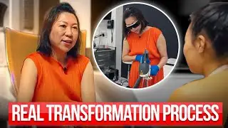 Fotona TightSculpting Explained | Fat Reduction + Skin Tightening (REAL PATIENT RESULTS)