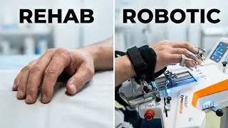 (18,500$) AMADEO Tyromotion Finger-Hand-Rehabilitation (2020 Year) [For Sale Worldwide]