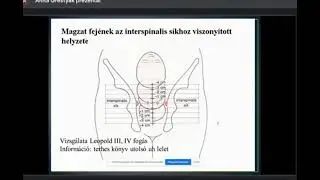A méhszáj vizsgálata, Grestyák Anita szülésznő előadása