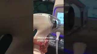 Acne scar removal machine, 400C Fractional needle acne scar removal machine #acnescars