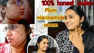 செம்ம changes💯product that changed my skin⭐️Niacinamide serum/which is best/how to use/honest review