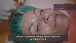 Jett Plasma Lift - o&scaron;etřen&iacute; obličeje