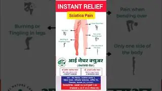 Simple Exercises for Instant Sciatica Pain Relief  #backpain #shortsfeed #yoga #naturalhealing