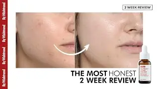 The Most Honest 2 Week Review | [BY WISHTREND] Pure Vitamin C 15% with Ferulic Acid (바이위시트렌드 페룰릭애씨드)