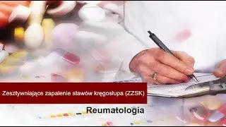 Zesztywniające zapalenie stawów kręgosłupa (ZZSK)