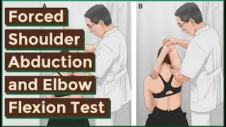 Тест на принудительное отведение плеча и сгибание локтя | SLAP Tear
