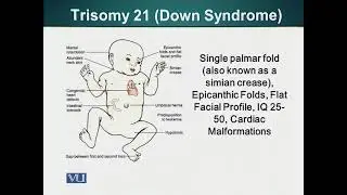 Autosomal Cytogenetic Disorders | Cell Biology | BIO5105_Topic208