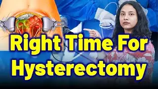 When Is the Right Time for a Hysterectomy Due to Fibroids? | Treatment Cure | Gynaecology Homeopathy