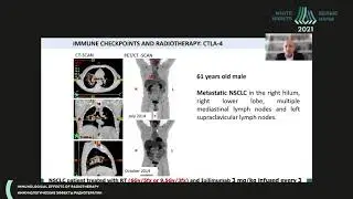 Immunological effects of the Radiotherapy (Jorge Contreras)