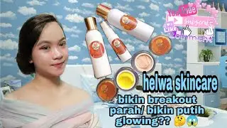 Review Helwa Skincare, bikin muka makin kusem?? 🤯🤯