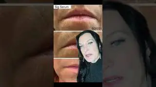 Got Lines, wrinkles, sagging Skin? Check out SIG-1273 Serum #antiaging #skincareroutine #collagen