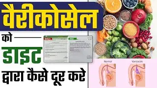 वैरीकोसेल को डाइट द्वारा कैसे दूर करे  | Varicocele Cure at Home Without Surgery | Dr Health