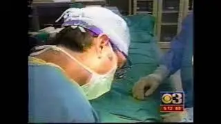 5   CBS Local News   Beating Heart Surgery