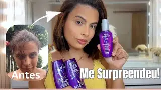 Elseve collagen Filter: testei o kit completo e o resultado me surpreendeu